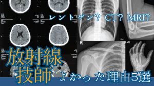 放射線技師でよかった理由５選