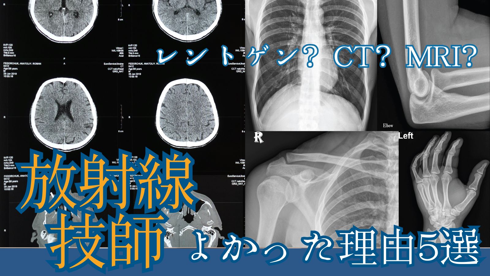 放射線技師でよかった理由5選